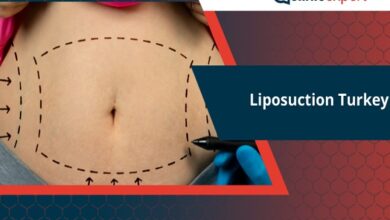 Da Cost of Liposuction Surgery In Turkey